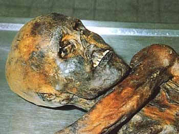 Homme de Similaun (Ötzi) : Gros plan sur la tête d'Ötzi.